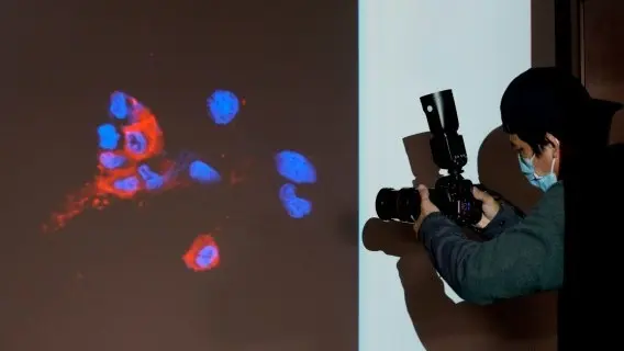 Immunofluorescence staining of Omicron infected cells in Hong Kong